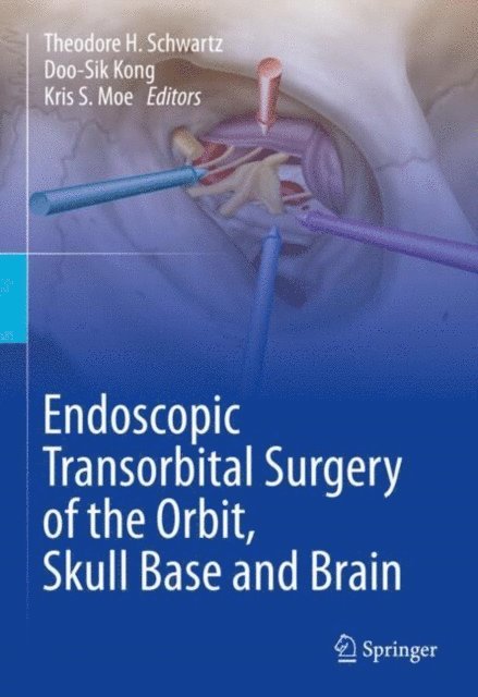 Kris S. Moe, Doo-Sik Kong, Theodore H. Schwartz - Endoscopic Transorbital Surgery of the Orbit, Skull Base and Brain, E-bok