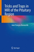 Tricks and Traps in MRI of the Pituitary Region