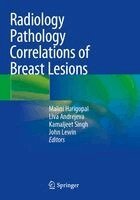 Malini Harigopal, Liva Andrejeva, Kamaljeet Singh, John Lewin - Radiology Pathology Correlations of Breast Lesions, Häftad