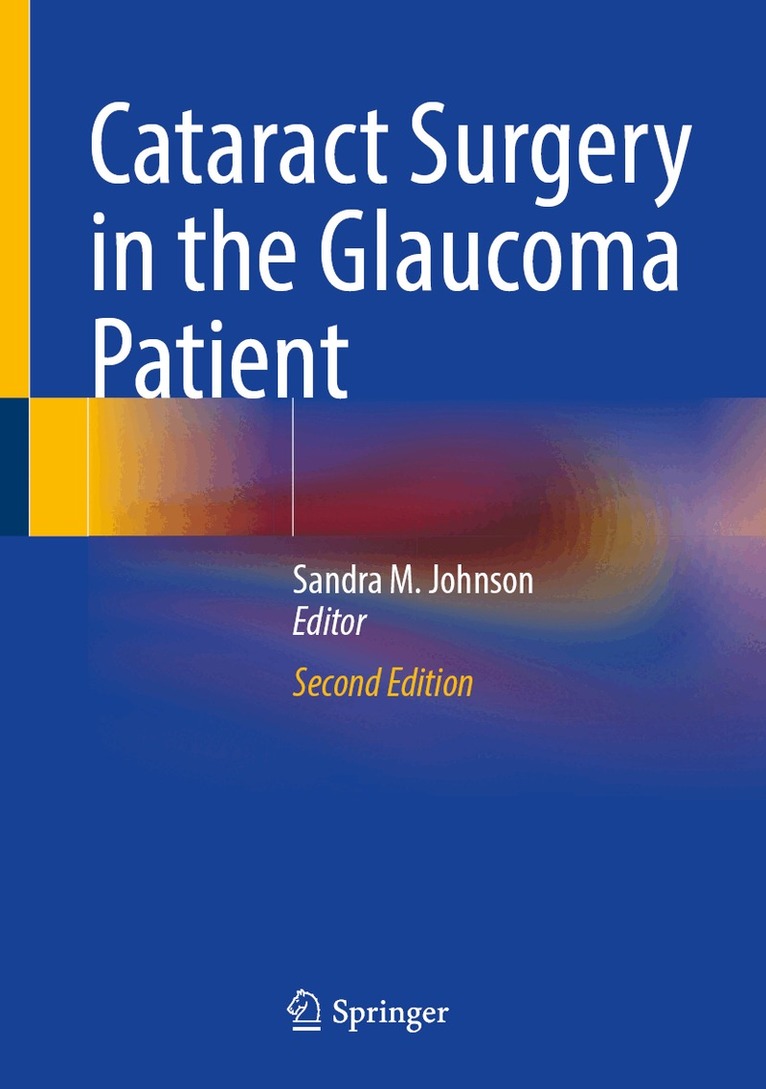 Sandra M. Johnson - Cataract Surgery in the Glaucoma Patient, Inbunden
