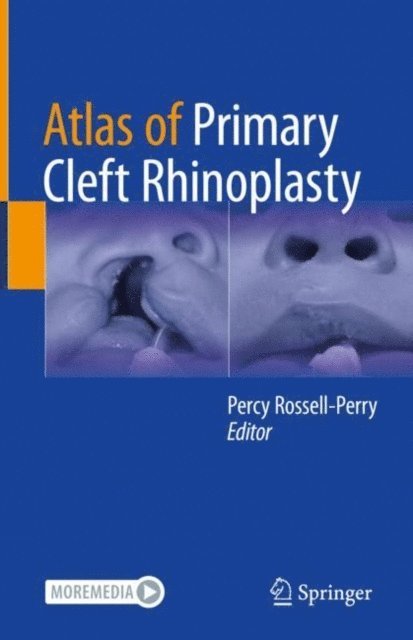 Percy Rossell-Perry - Atlas of Primary Cleft Rhinoplasty, E-bok