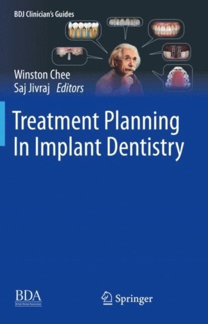 Saj Jivraj, Winston Chee - Treatment Planning In Implant Dentistry, E-bok