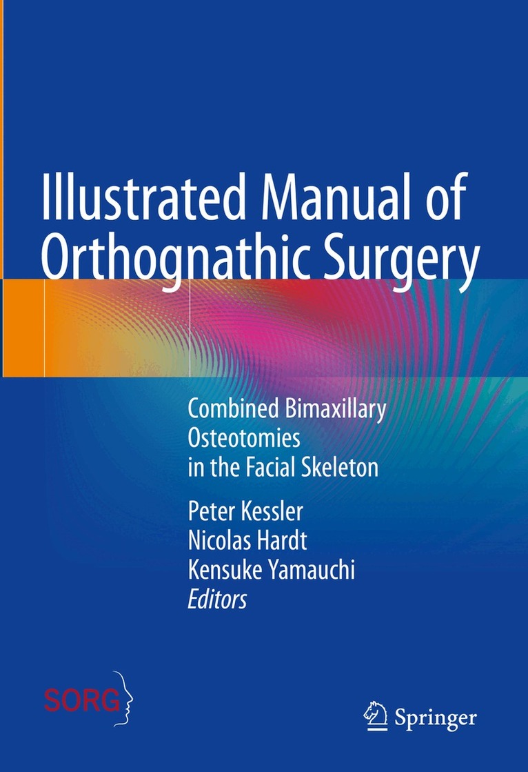 Peter Kessler, Nicolas Hardt, Kensuke Yamauchi - Illustrated Manual of Orthognathic Surgery, Inbunden. Tillgänglighet: Kommande