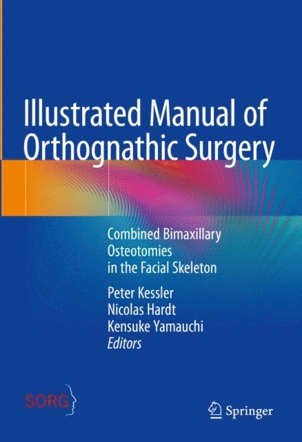 Kensuke Yamauchi, Nicolas Hardt, Peter Kessler - Illustrated Manual of Orthognathic Surgery, E-bok. Tillgänglighet: Lägg i varukorg