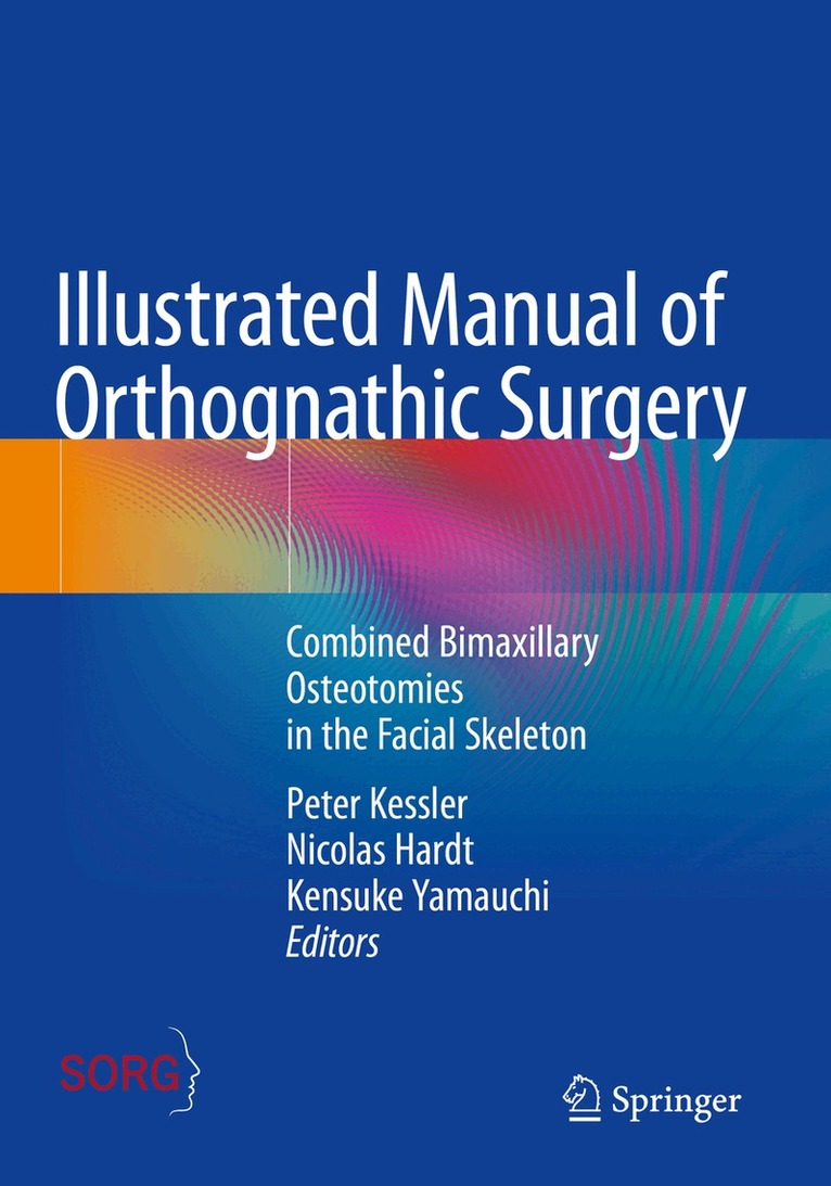 Peter Kessler, Nicolas Hardt, Kensuke Yamauchi - Illustrated Manual of Orthognathic Surgery, Häftad. Tillgänglighet: Lägg i varukorg