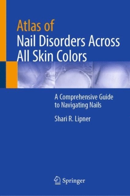 Shari R. Lipner - Atlas of Nail Disorders Across All Skin Colors, E-bok