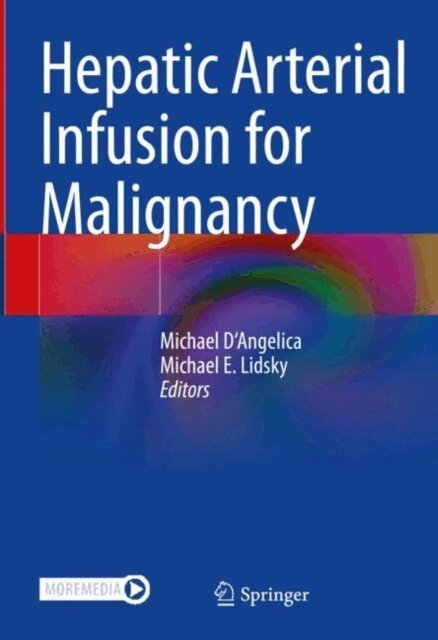 Michael Lidsky, Michael D'Angelica - Hepatic Arterial Infusion for Malignancy, E-bok