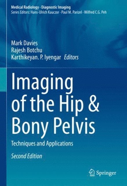 Karthikeyan. P. Iyengar, Rajesh Botchu, Mark Davies - Imaging of the Hip & Bony Pelvis, E-bok