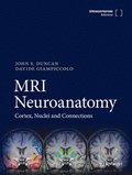 MRI Neuroanatomy