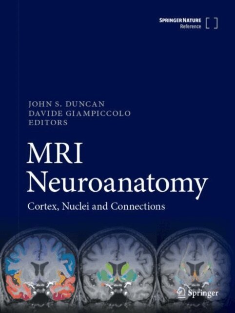 Davide Giampiccolo, John S. Duncan - MRI Neuroanatomy, E-bok