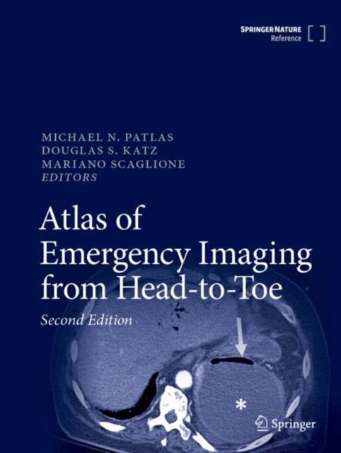 Mariano Scaglione, Douglas S. Katz, Michael N. Patlas - Atlas of Emergency Imaging from Head-to-Toe, E-bok