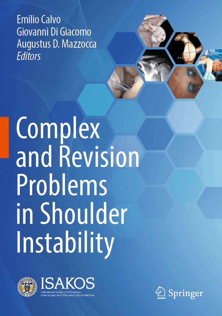 Emilio Calvo, Giovanni Di Giacomo, Augustus D. Mazzocca - Complex and Revision Problems in Shoulder Instability, Häftad