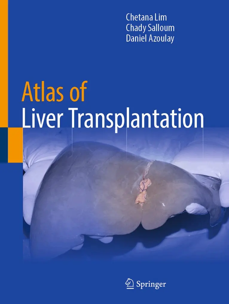 Chetana Lim, Chady Salloum, Daniel Azoulay - Atlas of Liver Transplantation, Inbunden. Tillgänglighet: Lägg i varukorg