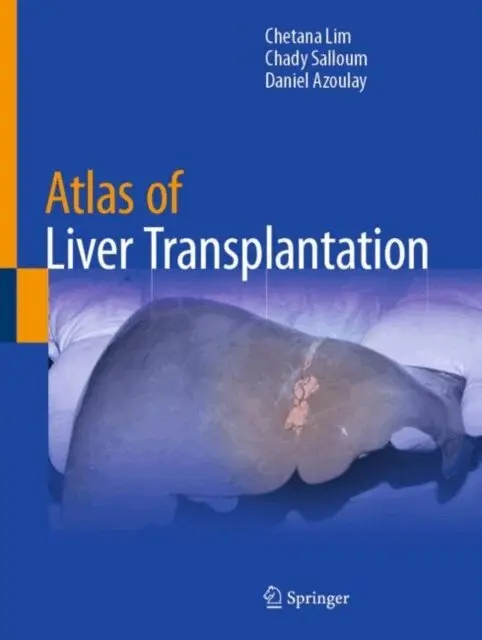 Daniel Azoulay, Chady Salloum, Chetana Lim - Atlas of Liver Transplantation, E-bok. Tillgänglighet: Lägg i varukorg