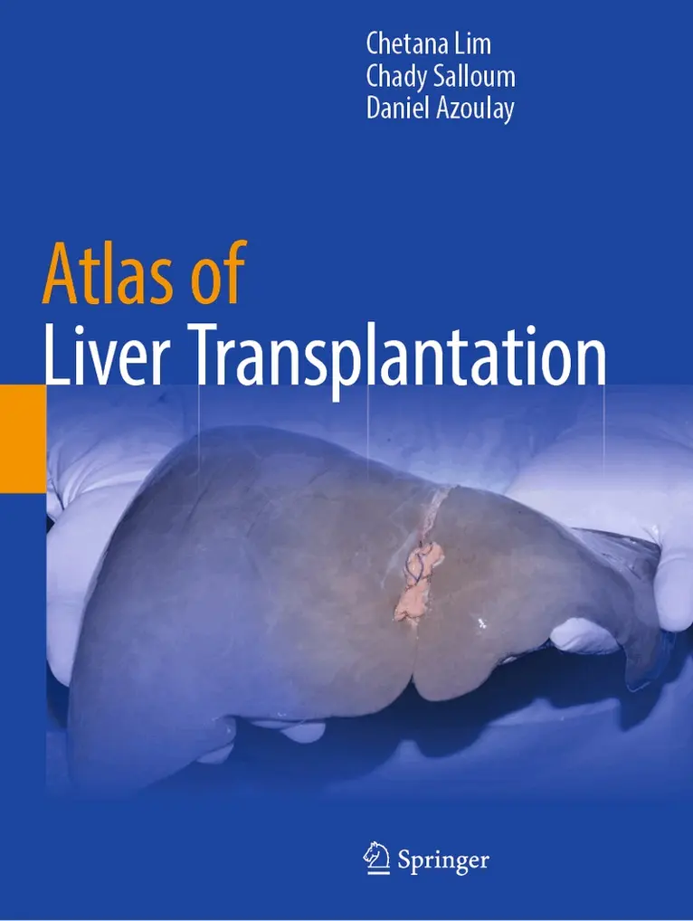 Chetana Lim, Chady Salloum, Daniel Azoulay - Atlas of Liver Transplantation, Häftad. Tillgänglighet: Lägg i varukorg