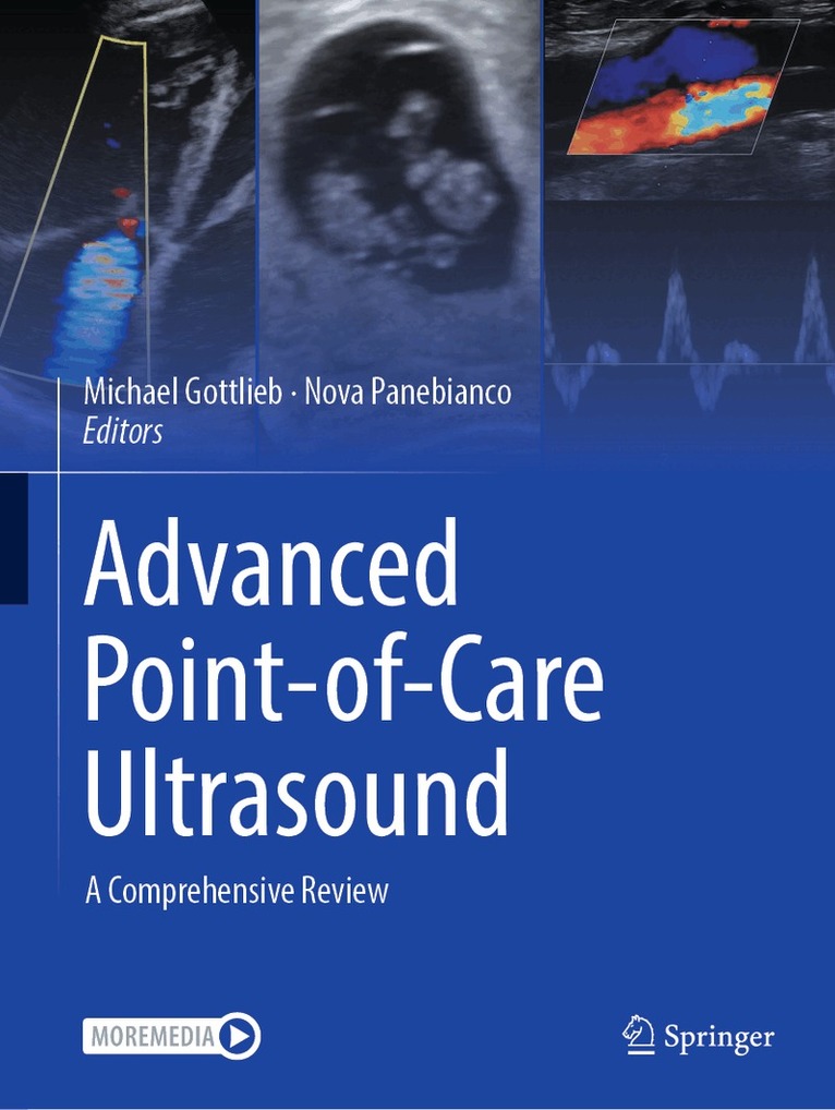 Michael Gottlieb, Nova Panebianco - Advanced Point-of-Care Ultrasound, Häftad. Tillgänglighet: Lägg i varukorg