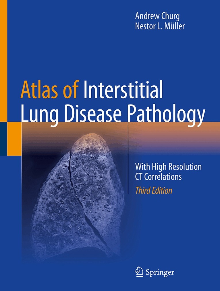 Andrew Churg, Nestor L. Müller - Atlas of Interstitial Lung Disease Pathology, Inbunden. Tillgänglighet: Lägg i varukorg
