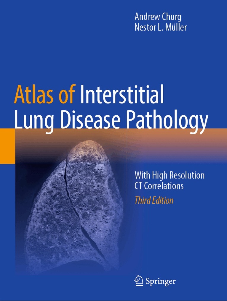 Andrew Churg, Nestor L. Müller - Atlas of Interstitial Lung Disease Pathology, Häftad. Tillgänglighet: Lägg i varukorg