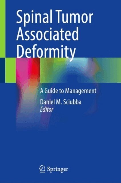 Daniel M. Sciubba - Spinal Tumor Associated Deformity, E-bok