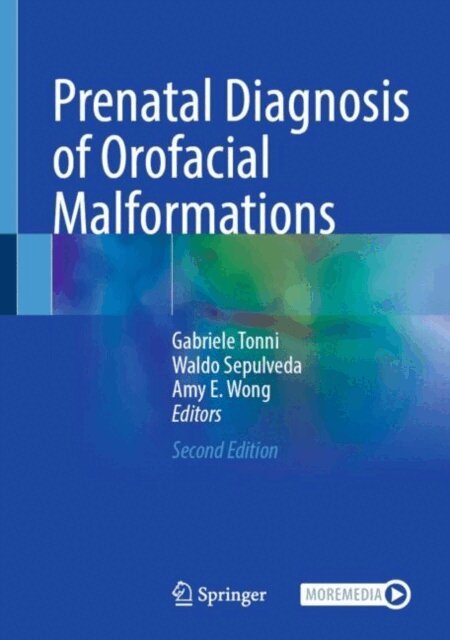 Amy E. Wong, Waldo Sepulveda, Gabriele Tonni - Prenatal Diagnosis of Orofacial Malformations, E-bok