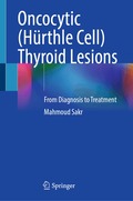 Oncocytic (H�rthle Cell) Thyroid Lesions