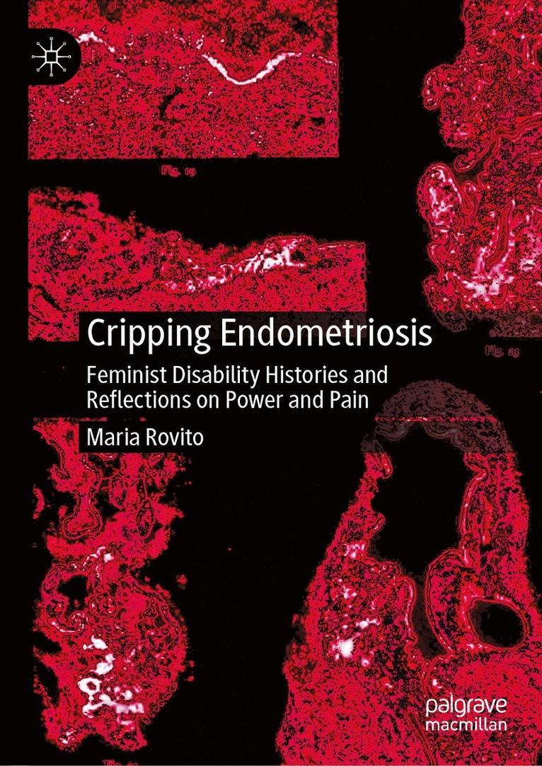 Maria Rovito - Cripping Endometriosis, Inbunden
