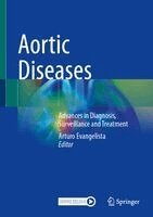 Arturo Evangelista - Aortic Diseases, Inbunden. Tillgänglighet: Kommande
