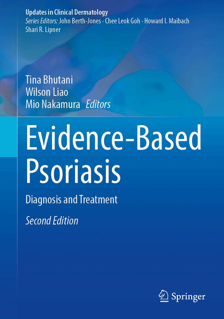Tina Bhutani, Wilson Liao, Mio Nakamura - Evidence-Based Psoriasis, Inbunden