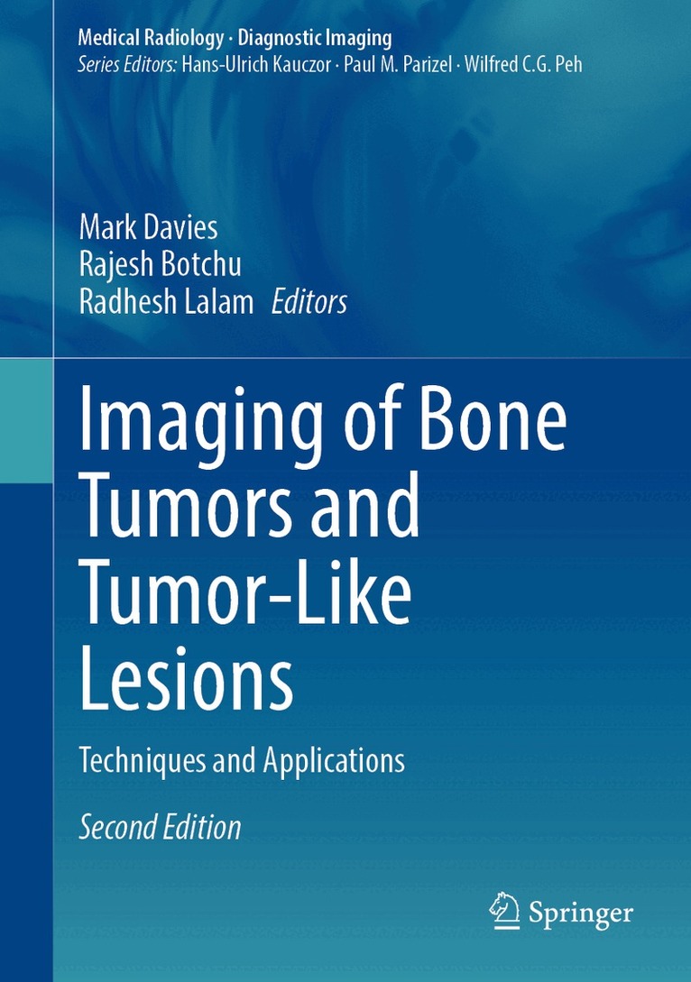 Mark Davies, Rajesh Botchu, Radhesh Lalam - Imaging of Bone Tumors and Tumor-Like Lesions, Inbunden