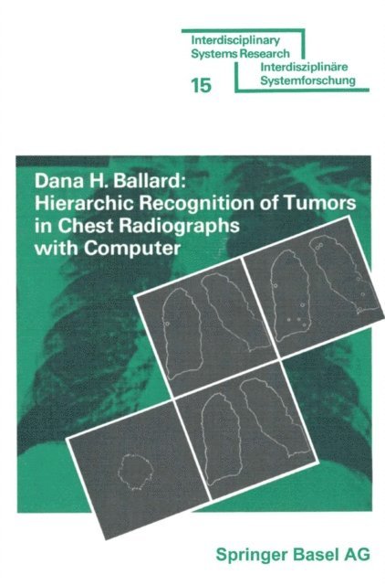 BALLARD - Hierarchic Recognition of Tumors in Chest Radiographs with Computer, E-bok