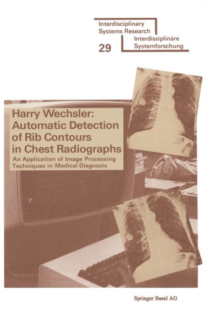 WECHSLER - Automatic Detection of Rib Contours in Chest Radiographs, E-bok
