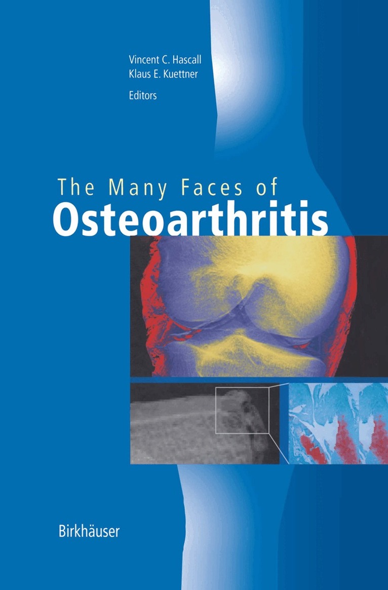 Many Faces of Osteoarthritis