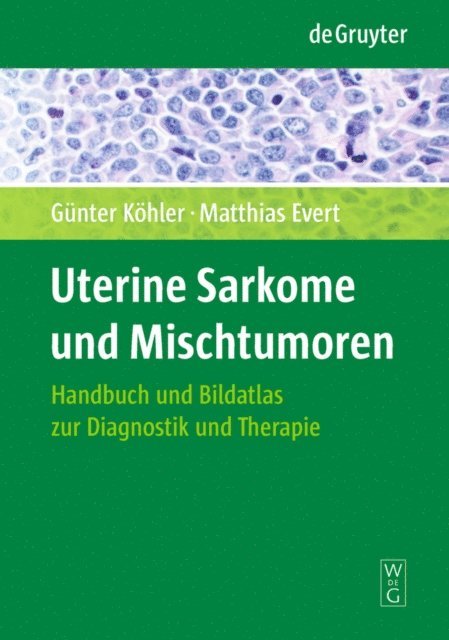 Matthias Evert, Gunter Kohler - Uterine Sarkome und Mischtumoren, E-bok