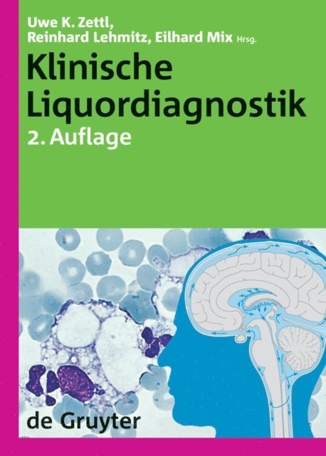 Eilhard Mix, Reinhard Lehmitz, Uwe K. Zettl - Klinische Liquordiagnostik, E-bok
