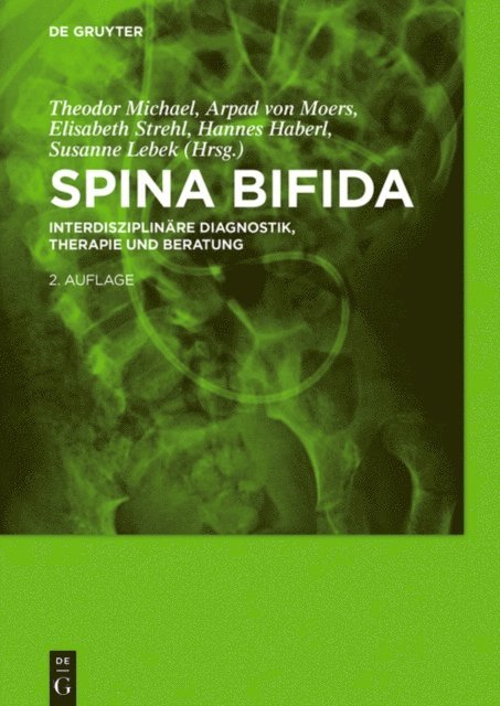 Susanne Lebek, Hannes Haberl, Elisabeth Strehl, Arpad Moers, Theodor Michael - Spina bifida, E-bok