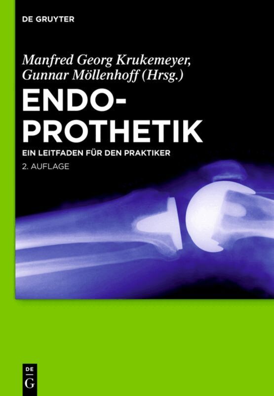 Manfred Georg Krukemeyer, Gunnar Möllenhoff - Endoprothetik, Inbunden