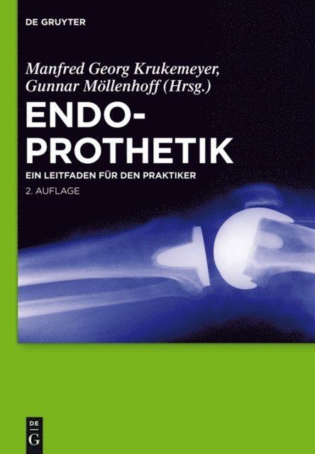 Gunnar Mollenhoff, Manfred Georg Krukemeyer - Endoprothetik, E-bok