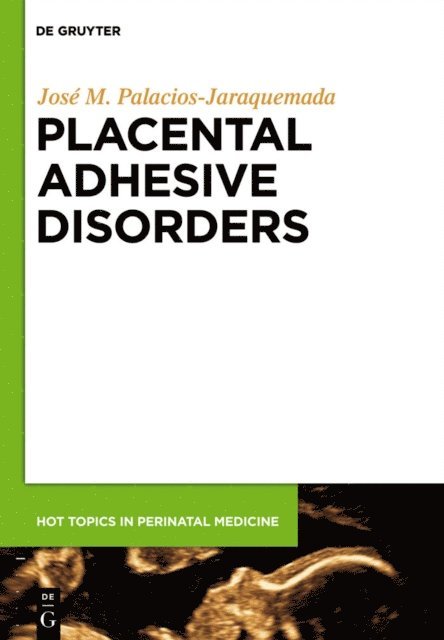 Jose Miguel Palacios-Jaraquemada - Placental Adhesive Disorders, E-bok