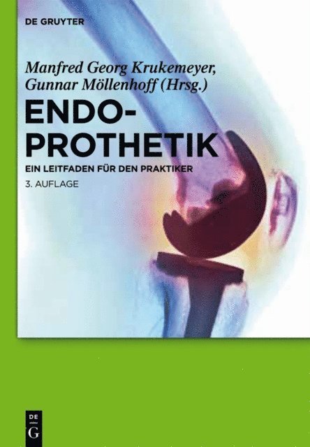 Gunnar Mollenhoff, Manfred Georg Krukemeyer - Endoprothetik, E-bok