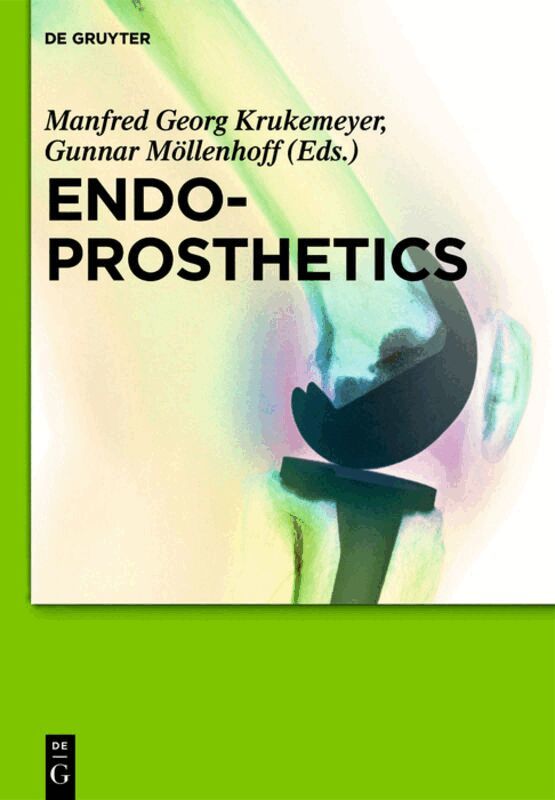 Manfred Georg Krukemeyer, Gunnar Möllenhoff - Endoprosthetics, Inbunden