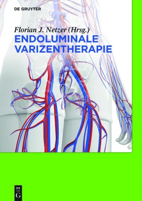 Endoluminale Varizentherapie