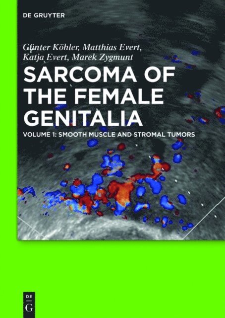 Marek Zygmunt, Katja Evert, Matthias Evert, Gunter Kohler - Smooth muscle and stromal tumors and prevention of inadequate surgery, E-bok