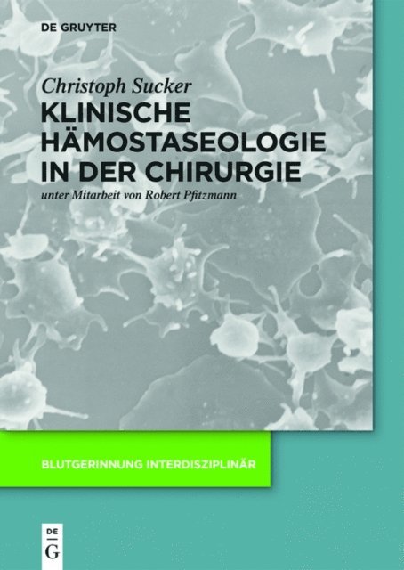 Christoph Sucker - Klinische Hämostaseologie in der Chirurgie, E-bok. Tillgänglighet: Lägg i varukorg