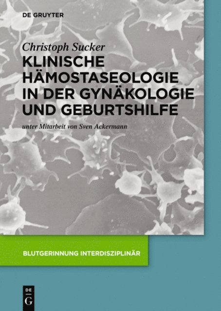 Christoph Sucker - Klinische Hämostaseologie in der Gynäkologie und Geburtshilfe, E-bok. Tillgänglighet: Lägg i varukorg