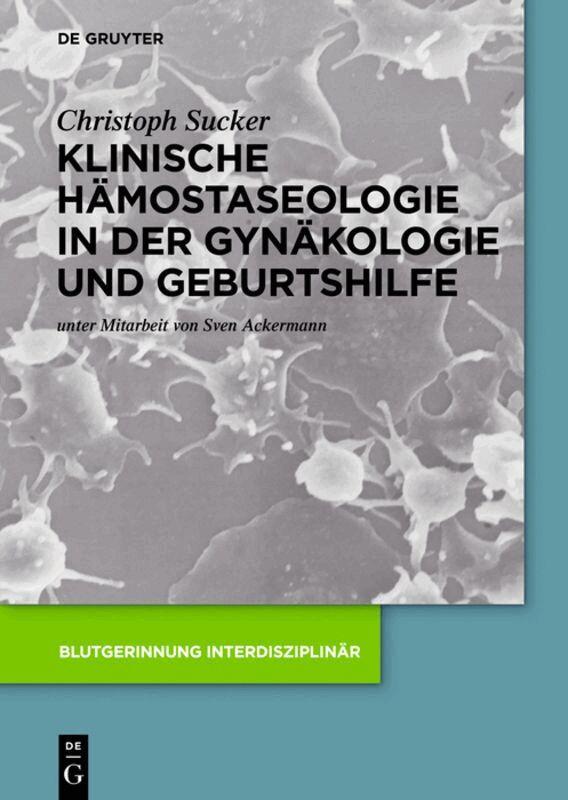 Christoph Sucker - Klinische Hämostaseologie in der Gynäkologie und Geburtshilfe, Inbunden. Tillgänglighet: Lägg i varukorg