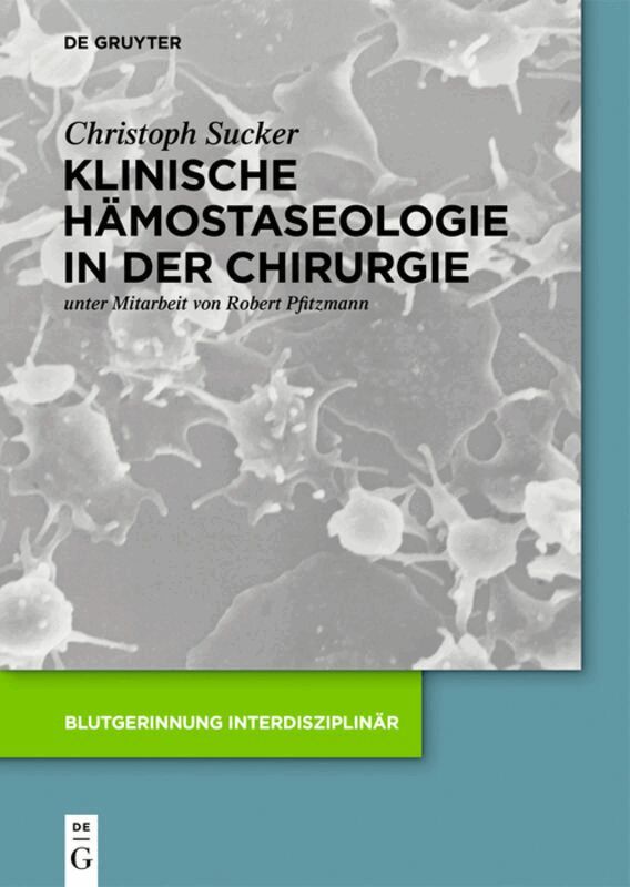 Christoph Sucker - Klinische Hämostaseologie in der Chirurgie, Inbunden. Tillgänglighet: Lägg i varukorg