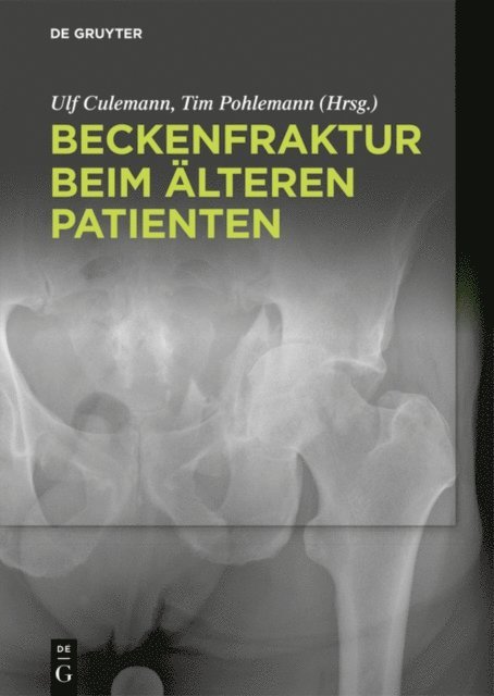 Tim Pohlemann, Ulf Culemann - Beckenfraktur beim älteren Patienten, E-bok