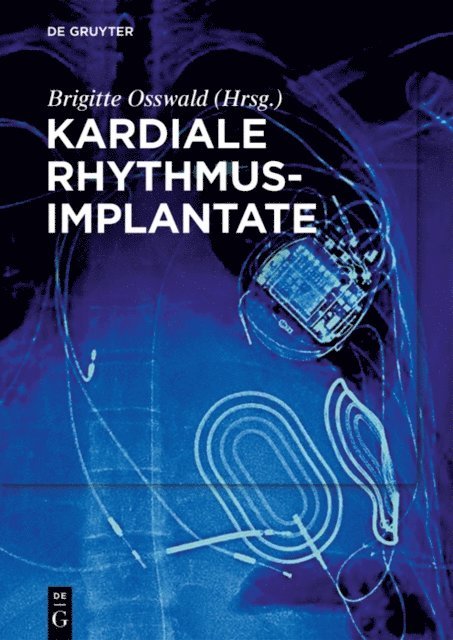 Brigitte Osswald - Kardiale Rhythmusimplantate, E-bok