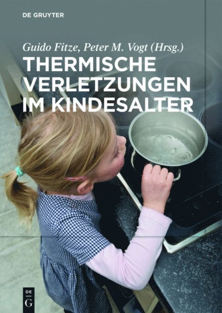 Peter M. Vogt, Guido Fitze - Thermische Verletzungen im Kindesalter, E-bok