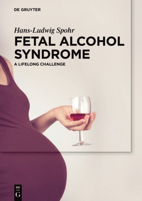 Hans-Ludwig Spohr - Fetal Alcohol Syndrome, E-bok